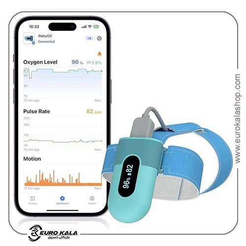 مانیتور اکسیمتر نوزاد برند Babytone  Baby Oxygen Monitor OS1