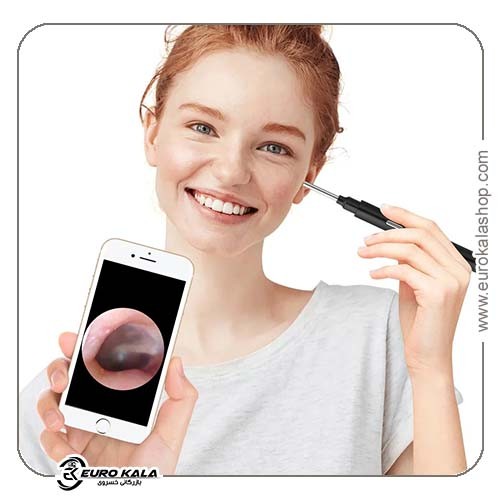 دوربین پاککننده جرم گوش